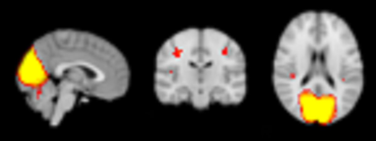 low resolution melodic result